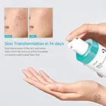 Anua - BHA 2% Gentle Exfoliating Toner - Image 3
