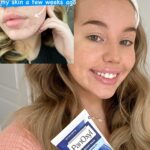 Panoxyl - Acne Creamy Wash Benzoyl Peroxide 4% Daily Control - Image 2