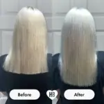 HairBurst - Healthy Hair Vitamins - Image 4