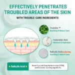 SOME BY MI - Micro Pin Spot Patch - Image 2