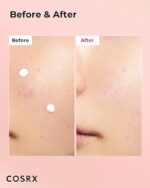 Cosrx - Drying Lotion - Image 2