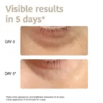 Iroha - Eye Contour Patches Anti-Age - Image 3