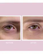 Youth Lab - Peptides Spring Hydra Gel Eye Patches - Image 2