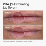 The Ordinary - PHA 5% Exfoliating Lip Serum - Image 3