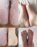 Iroha - Glycolic Acid Peeling & Exfoliation Socks - Image 2