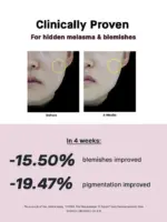 Cosrx - Niacinamide 15% - Image 3